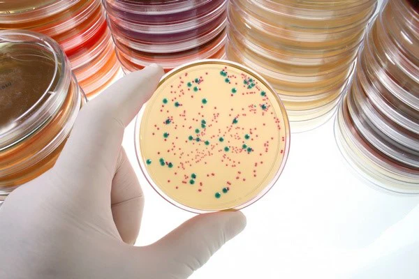 FOTO: Sitomeqalovirus infeksiyası adətən gizli keçir və yalnız laborator müayinələrlə aşkar olunur